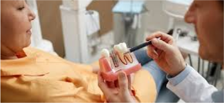 dental implants Dubai