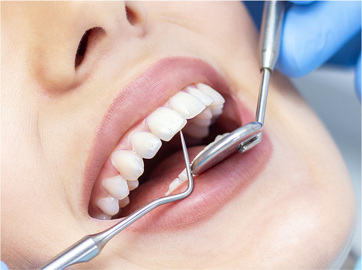 Dental Extraction Needed?