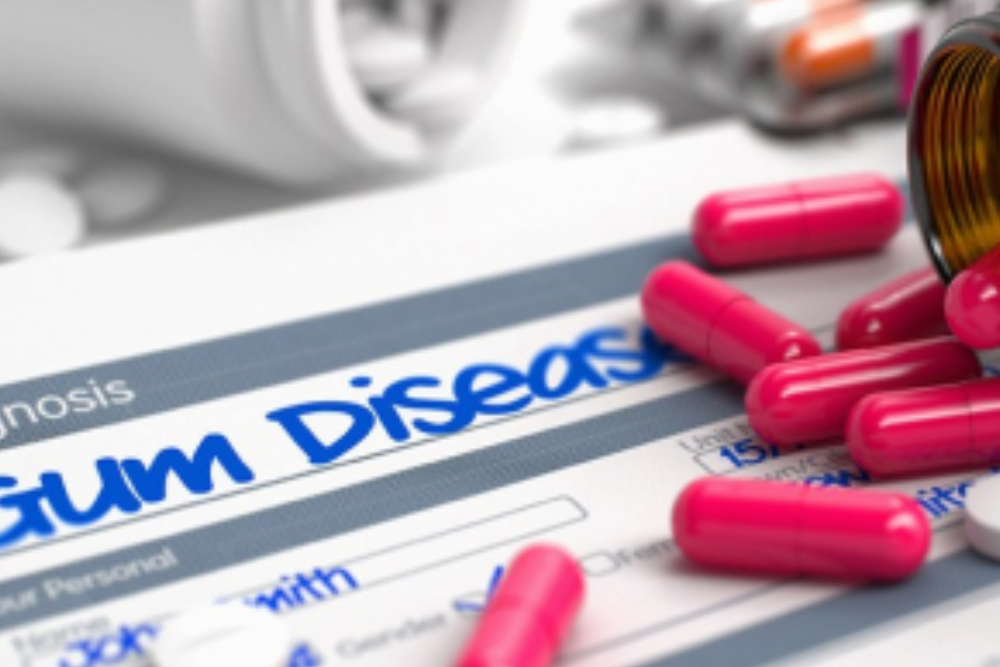 Gum Disease Treatment