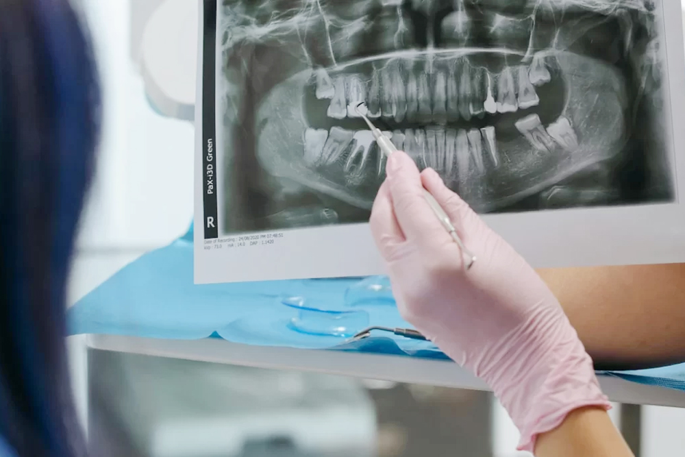 Panoramic Dental Imaging